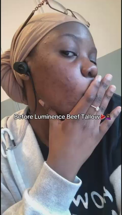 Whipped Tallow Cream 100 ml Pack of 1